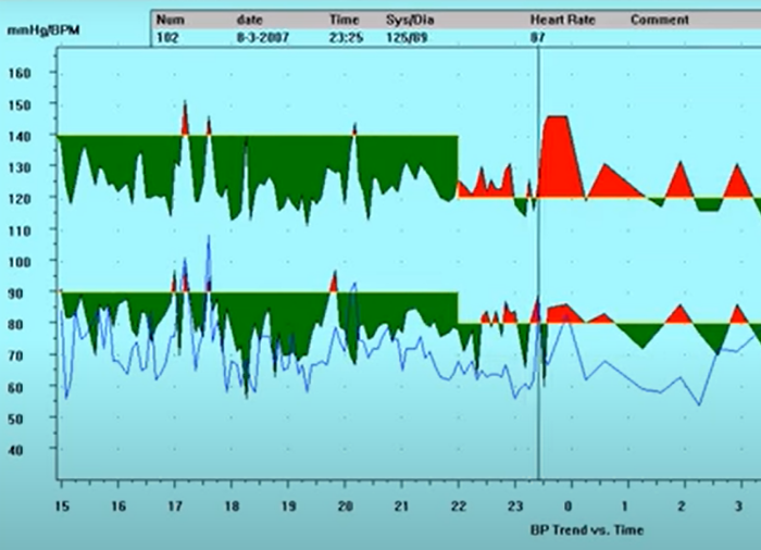 Holter: Monitor de presión ambulatoria que puede medir y monitorizar la presión arterial del cuerpo humano por 24 horas.