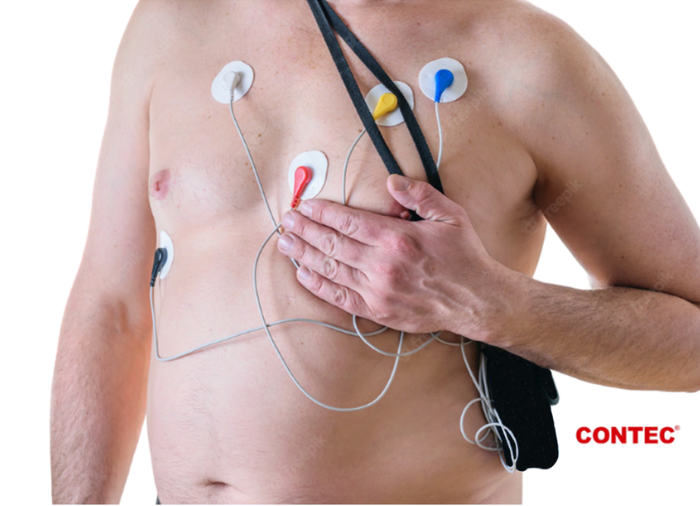 Holter: Integrado con tecnología avanzada puede grabar las ondas del ECG y sus alteraciones por 24 horas.