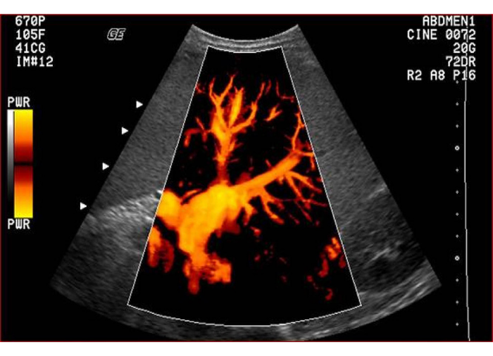 Eco doppler: El CMS1700B es un Ecógrafo Doppler integrado en su sistema operativo con la capacidad de realizar estudios en 3D y 4D.