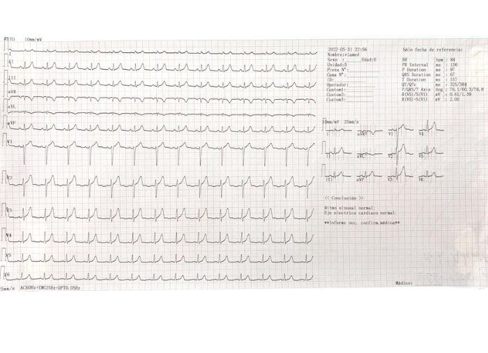 Electrocardiografo: Su pantalla LCD de alta definición permite el uso en áreas de poca iluminación y donde se requiera el confort del paciente.