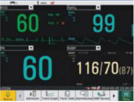 Monitor de Paciente: Múltiples modos de visualización