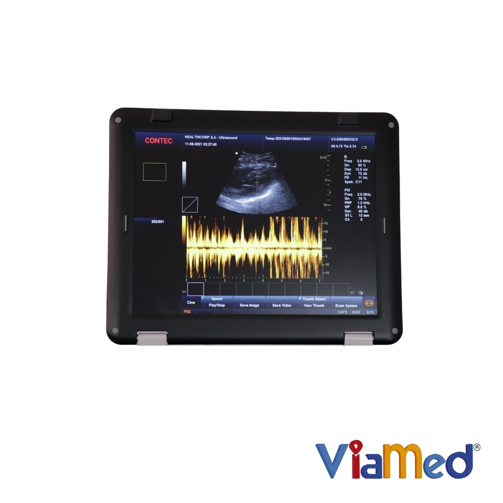 Ecografo Doppler color portátil, cardiología + 1 Transductor PHASED ARRAY, Contec.