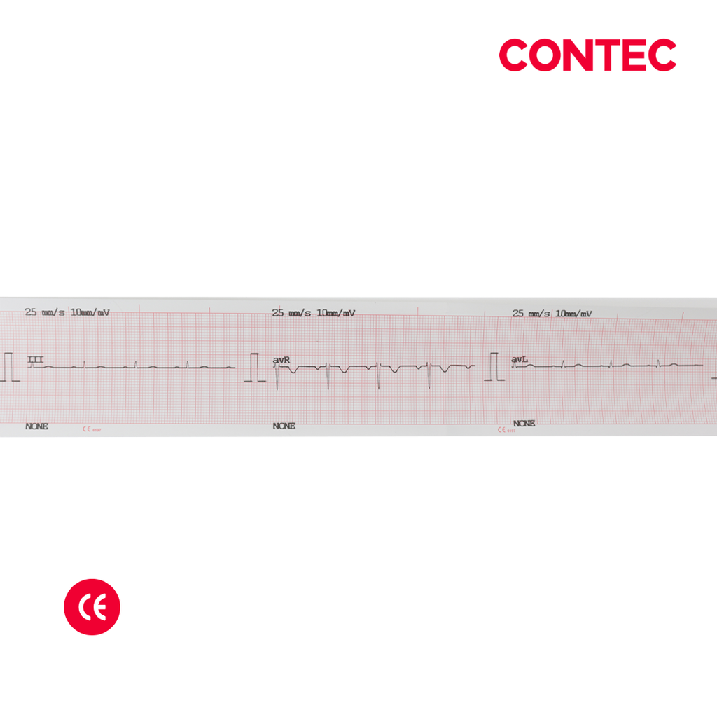 Electrocardiografo veterinario mono canal, CONTEC