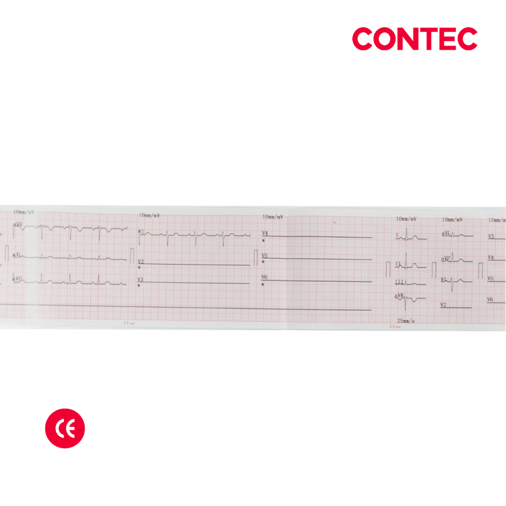 Electrocardiografo Veterinario, multicanal, Pantalla color 3.5&quot;, CONTEC