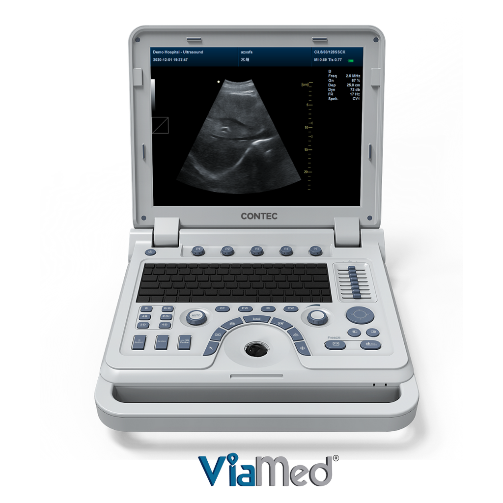 Ecografo Doppler color portátil, CARDIOLOGIA. Incluye Transductor PHASED ARRAY. Contec.