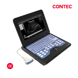 [CMS600P2] Ecografo portatil, 600P2. CONTEC